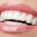 A Discreet Path to a Brighter You: Why Essex Residents are Choosing Invisalign for Smile Correction