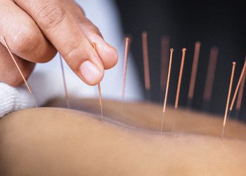 The Rising Popularity of Seeking the Best Acupuncture in London