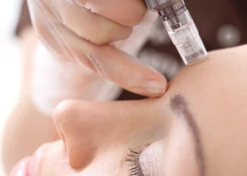 Unlocking the Benefits of Microneedling in Jersey: A Comprehensive Guide