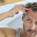 Key Factors in Selecting a Hair Loss Clinic Near Me