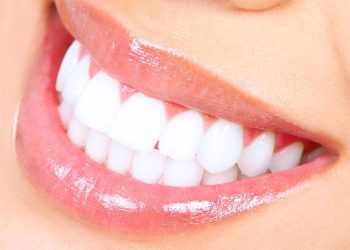 Your Guide to Teeth Whitening in New Malden: Procedures and Aftercare