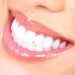 Your Guide to Teeth Whitening in New Malden: Procedures and Aftercare