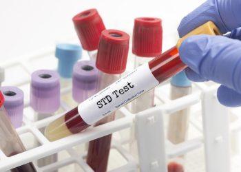 STD Testing: A Key Component of Modern Healthcare