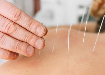 Acupuncture New Malden: Discovering the Ancient Art of Healing and Wellness in the Modern World