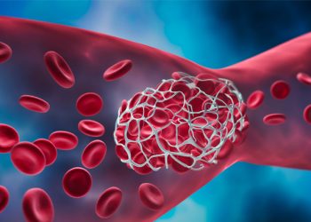 The Importance of Blood Clot Charities in Raising Awareness and Supporting Patients