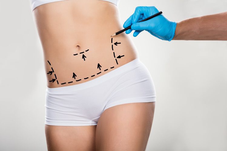 Cheap Cosmetic Surgery: Balancing Cost and Quality