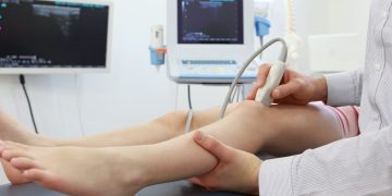 The Value of Private Musculoskeletal MSK Ultrasound London in Diagnosing Musculoskeletal Conditions