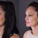 Why Credible Skin Tightening Clinics Always Display Xerf Treatment Before After Evidence